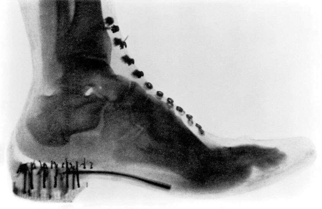 Early X-ray of a boot worn by a woman,1896