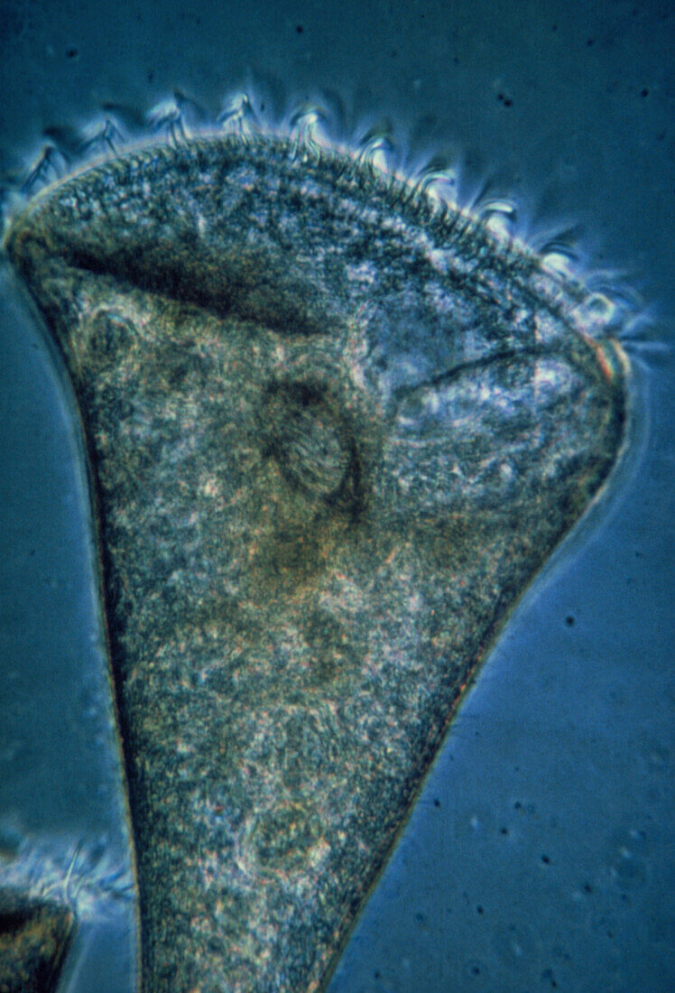 LM of Stentor sp.,a ciliate protozoan