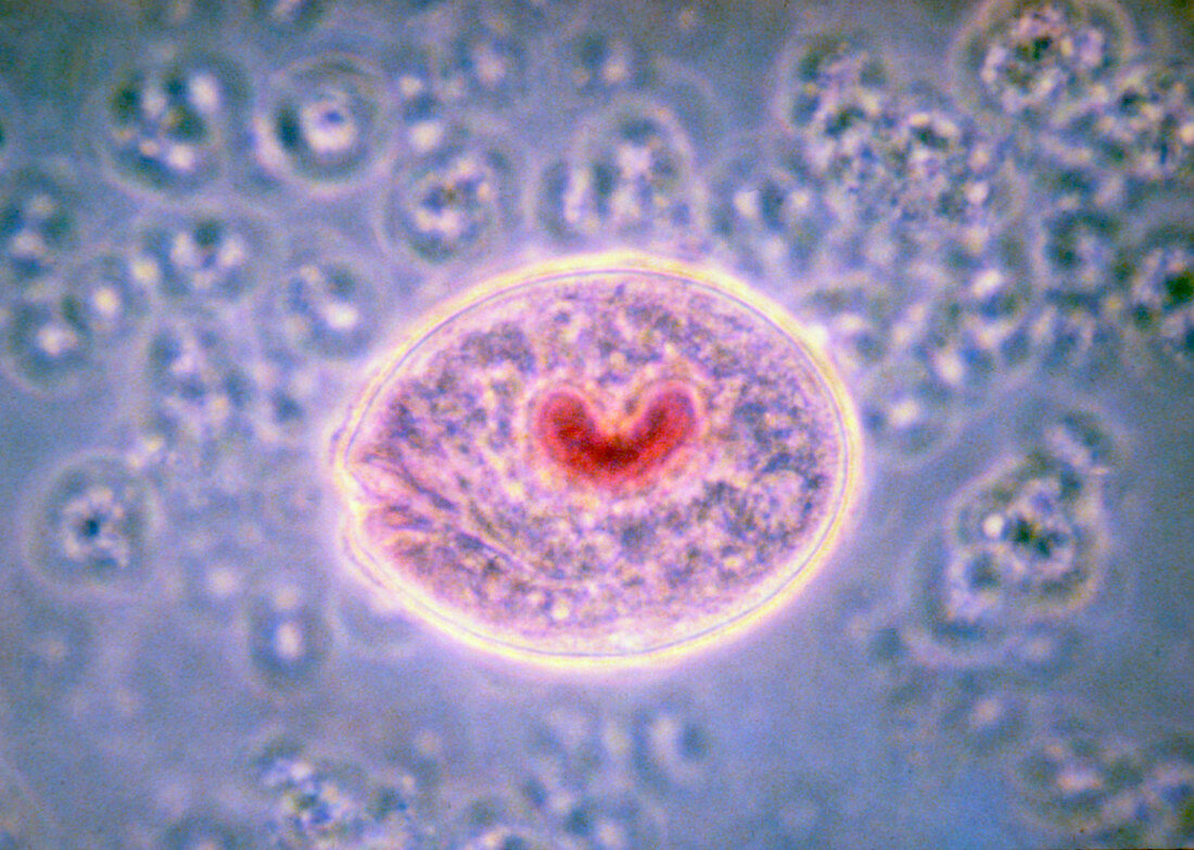 LM of Balantidium coli,a parasitic protozoan