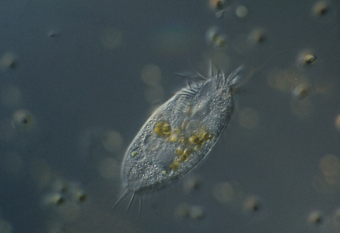 Light micrograph of Stylonychia sp