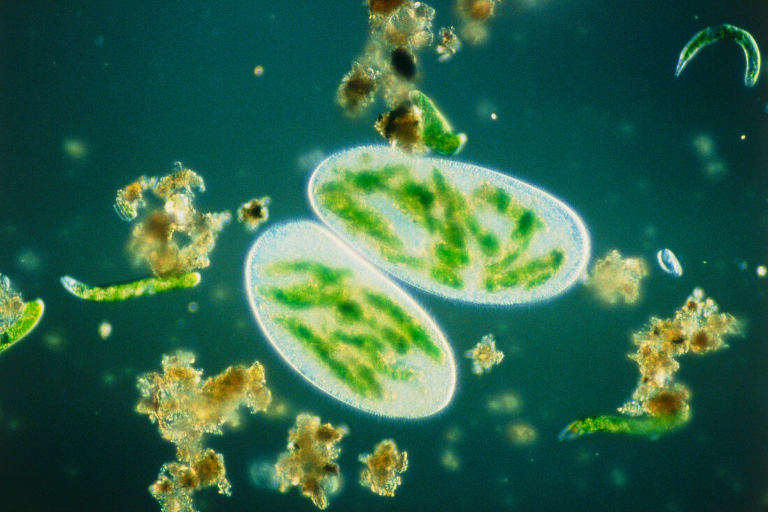 LM of two Paramecium,showing food vacuoles