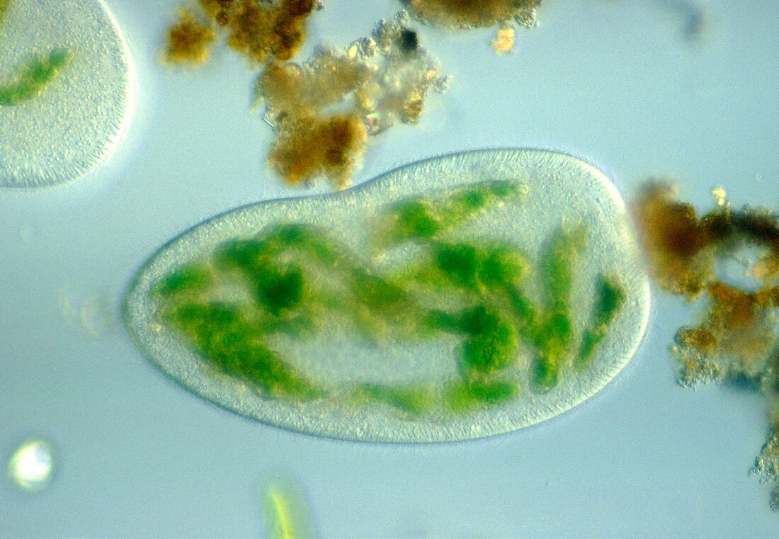 LM of a Paramecium,showing food vacuoles