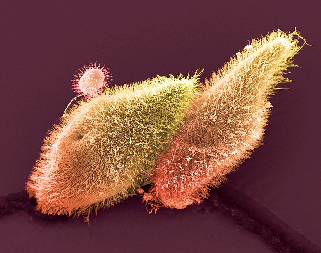 Paramecium protozoa,SEM