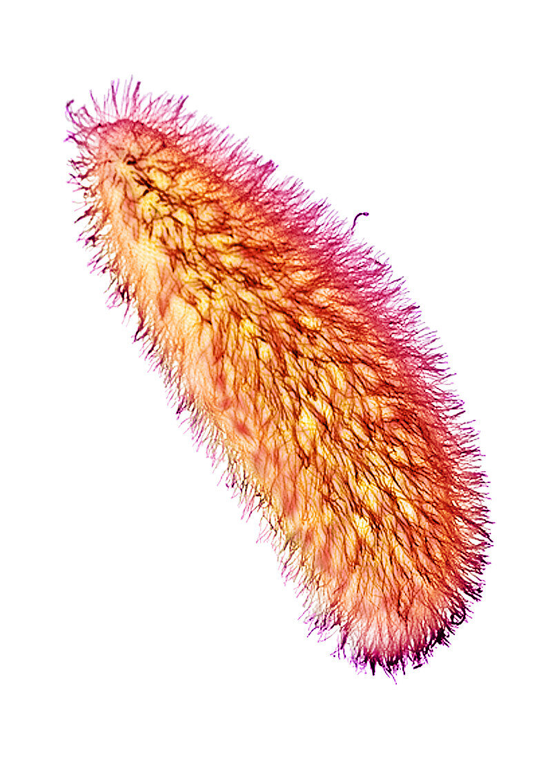 Paramecium protozoan,SEM