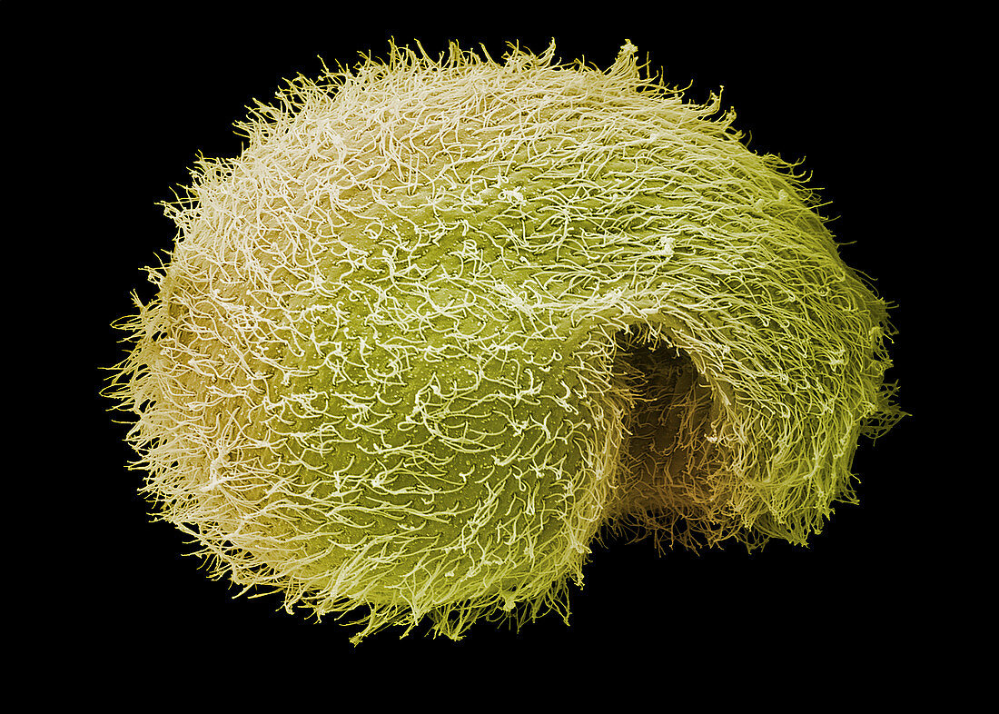 Breslauides ciliate protozoan,SEM