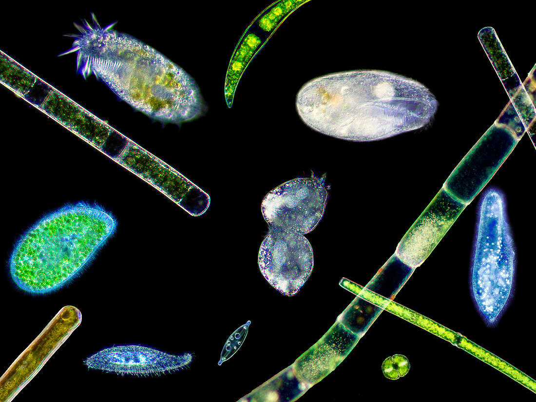Ciliate protozoa,light micrograph
