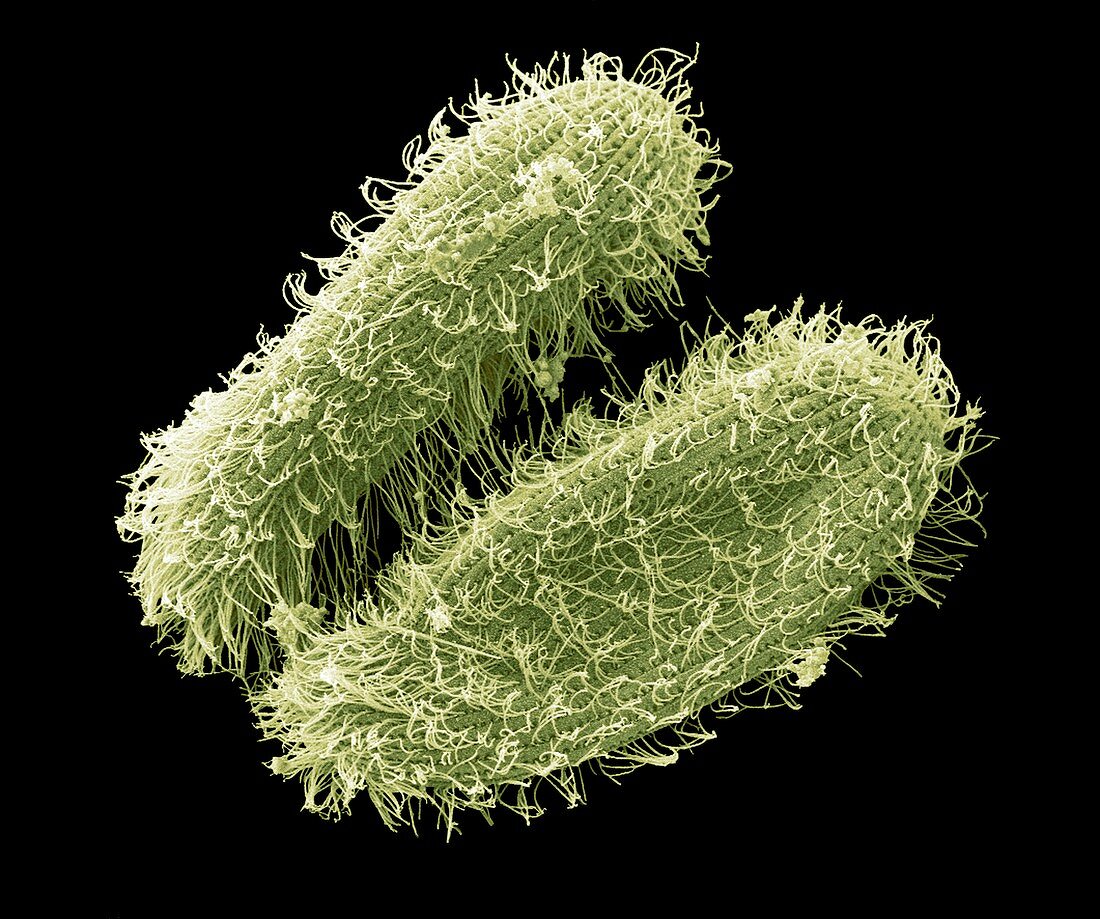 Ciliate protozoa,SEM