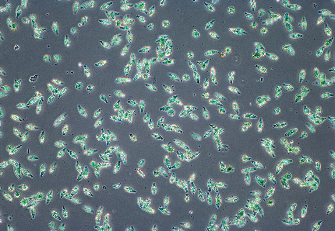 LM of the flagellate protozoan Euglena viridis