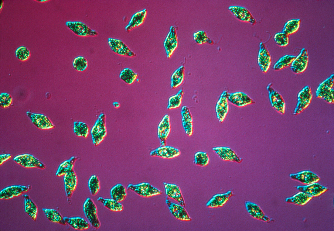 LM of the flagallate protozoan Euglena viridis