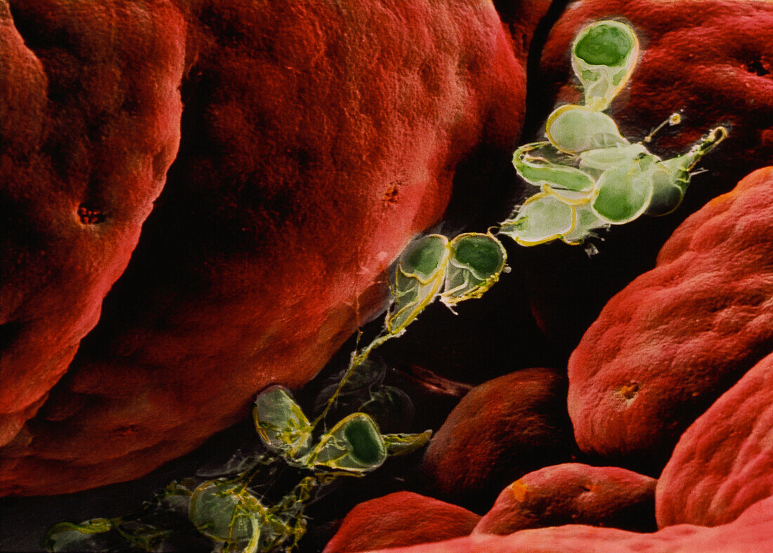 SEM of Giardia lamblia in human intestine