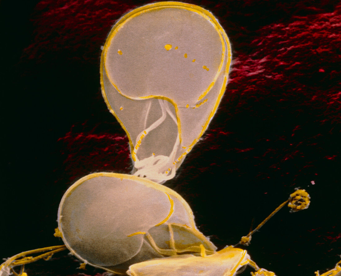 Coloured SEM of Giardia lamblia in human intestine