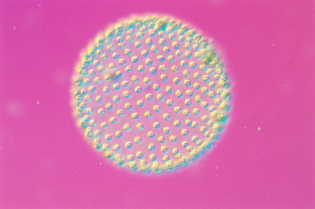 LM of colony of the freshwater flagellate,Volvox