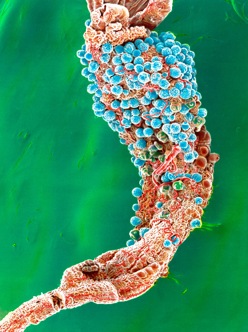 SEM malaria oocysts on mosquito stomach
