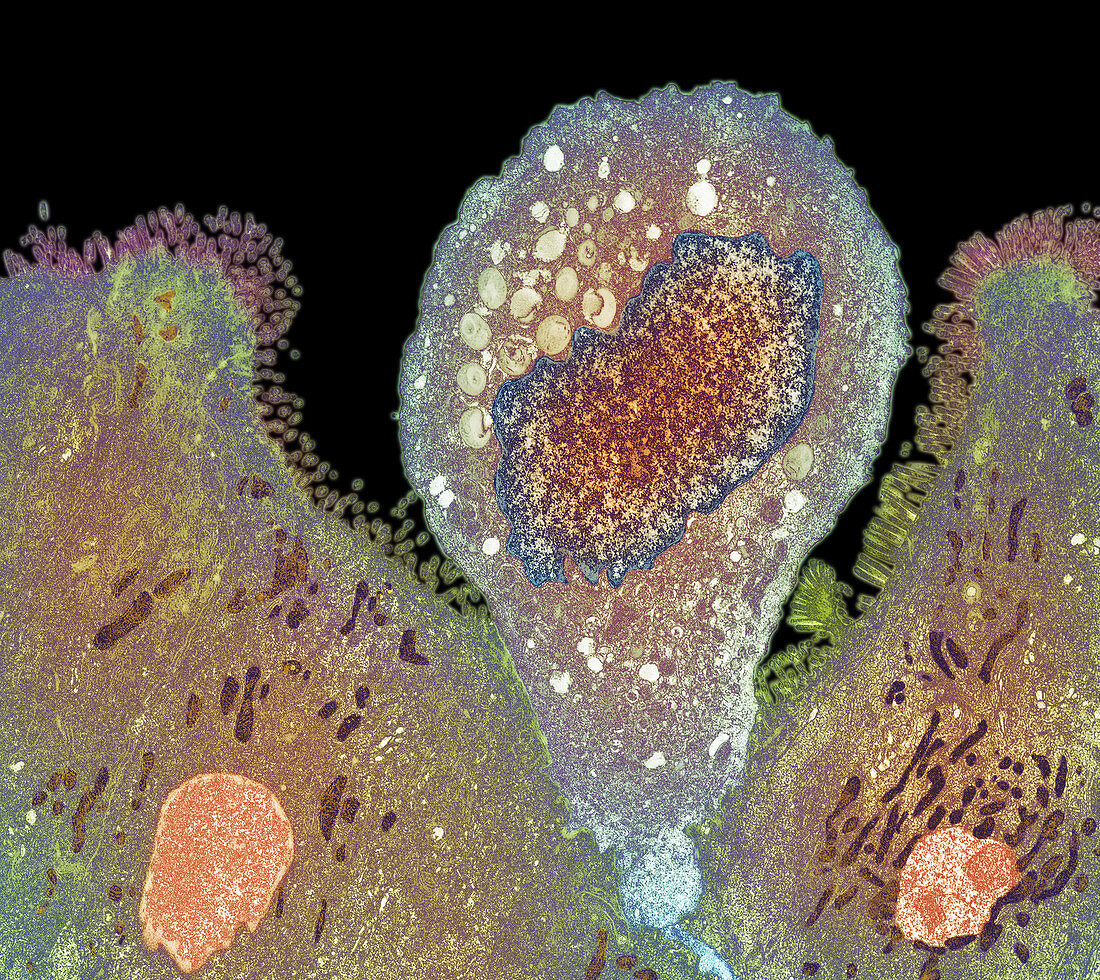 Enterocytozoon sp. parasite,coloured TEM