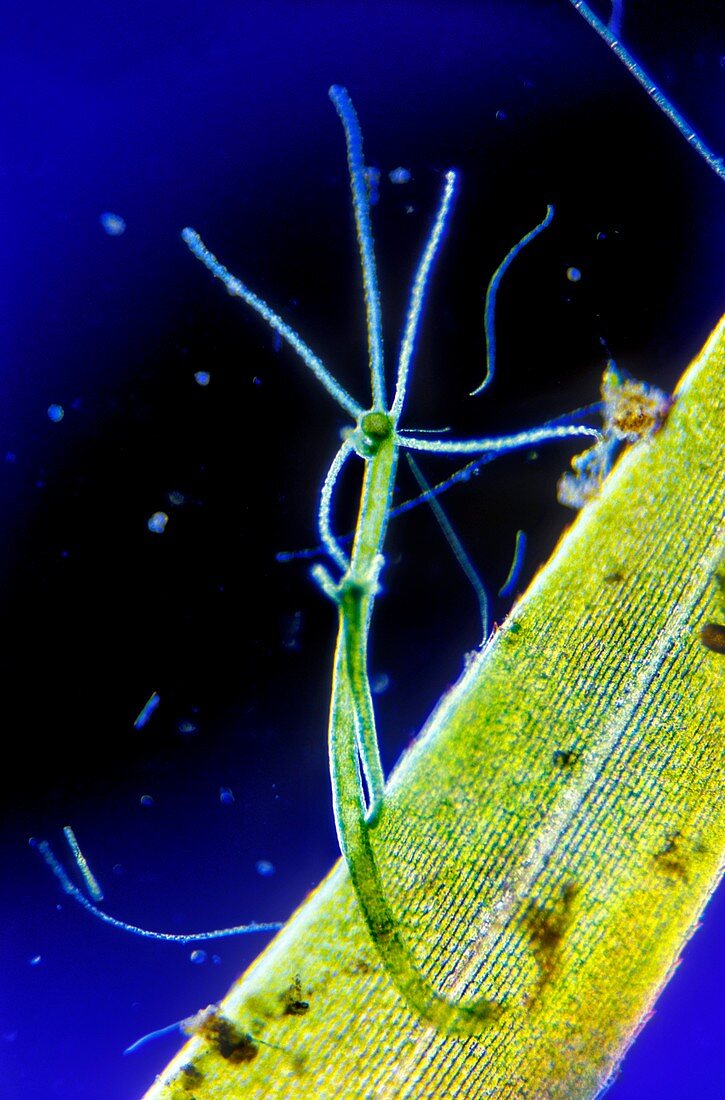 Freshwater Hydra,light micrograph