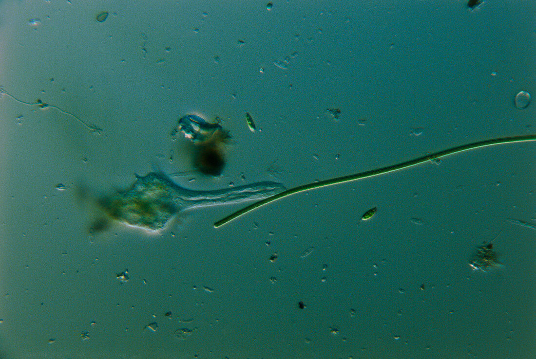 Amoeba with blue-green alga