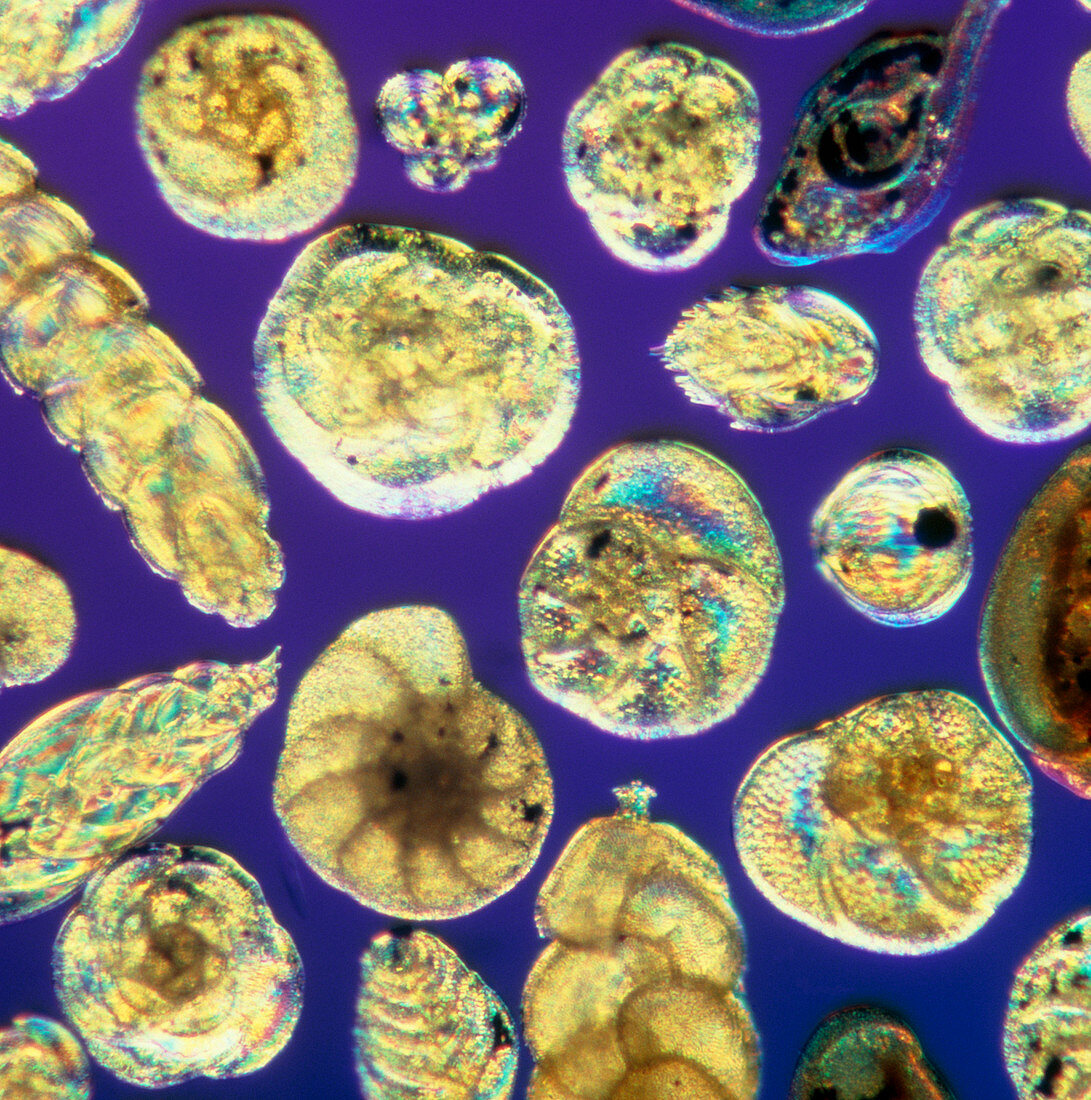 LM of assorted Foraminifera shells
