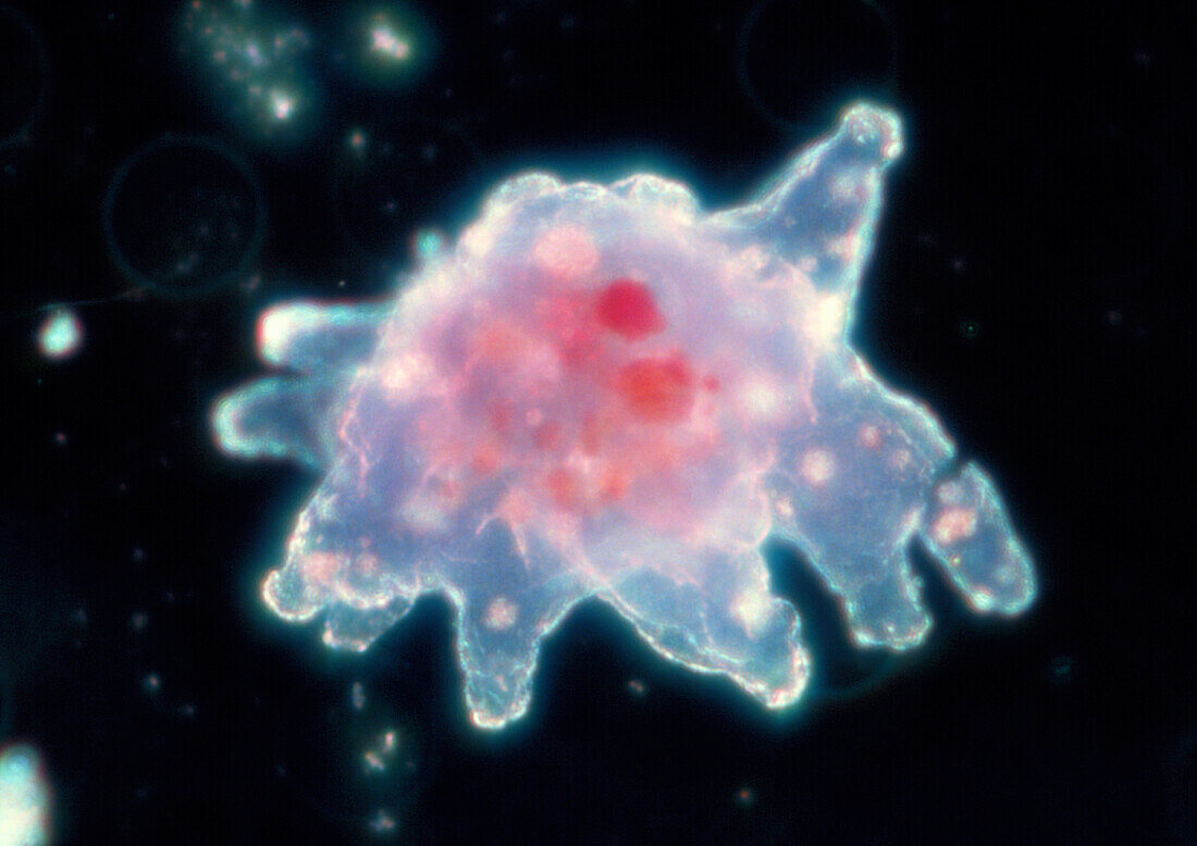 LM of amoeba proteus extending it's false feet