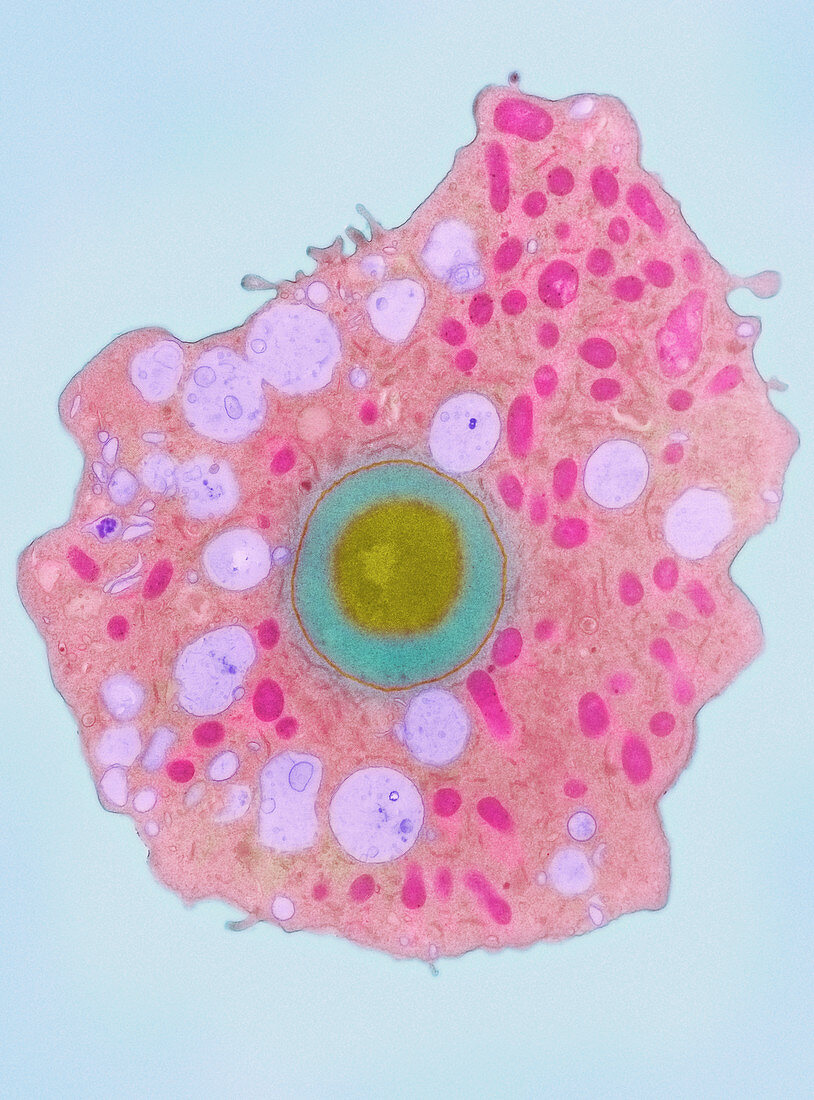 Naegleria fowleri protozoan,TEM