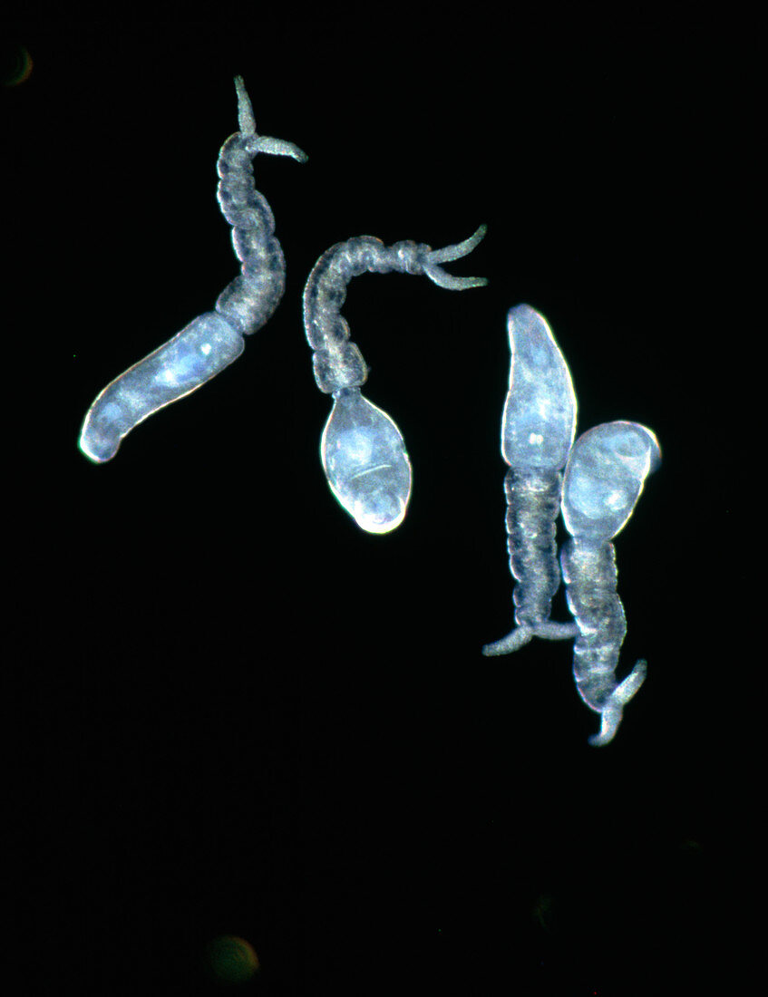 LM of cercariae larvae