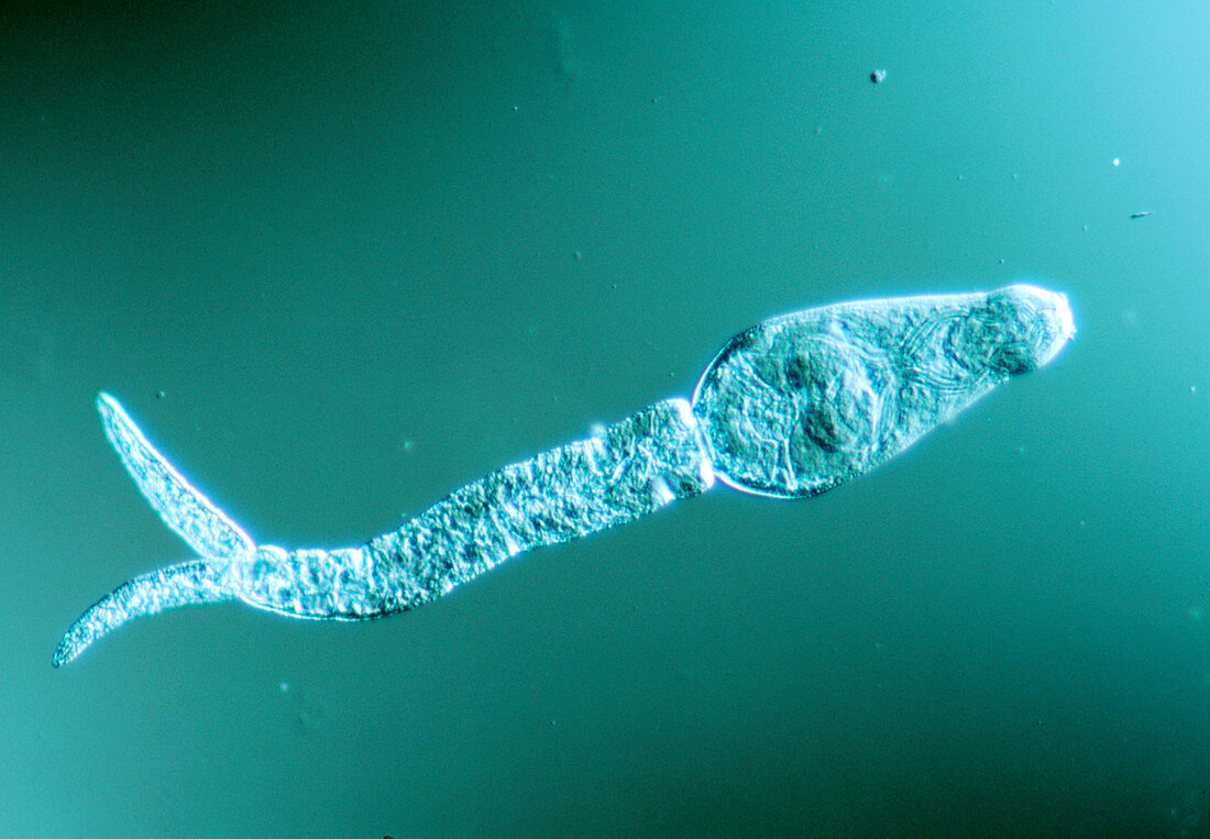 Schistosoma mansoni: LM of larva