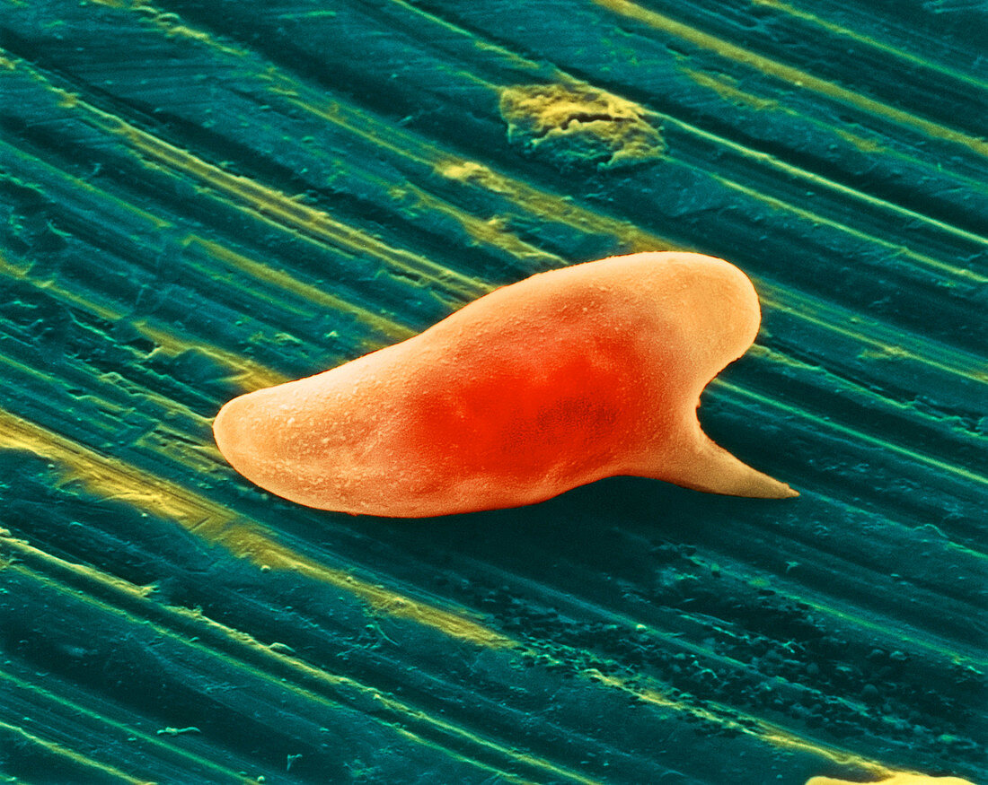 Coloured SEM of Schistosoma mansoni parasite egg