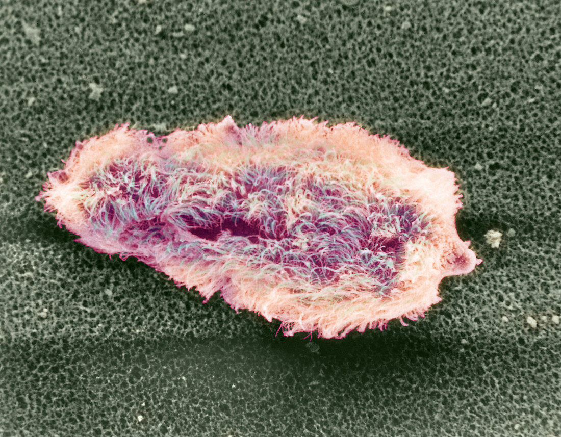 Coloured SEM of miracidium of schistosome parasite