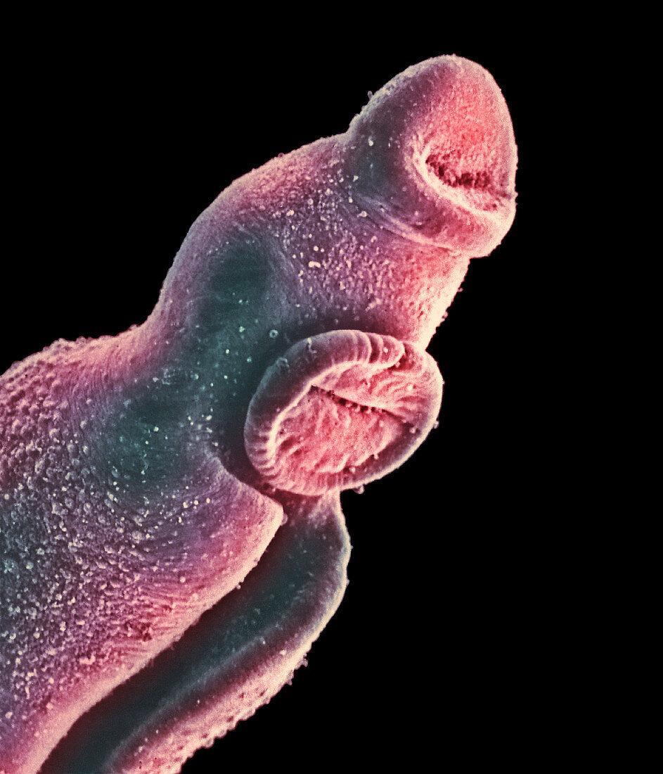 SEM of the head of a male schistosome parasite