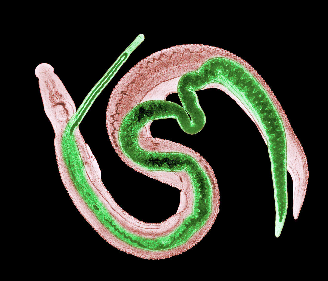 LM of male and female adult schistosome parasites