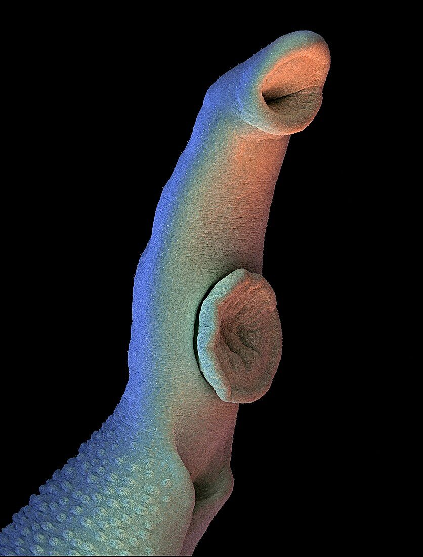 Schistosome fluke,SEM