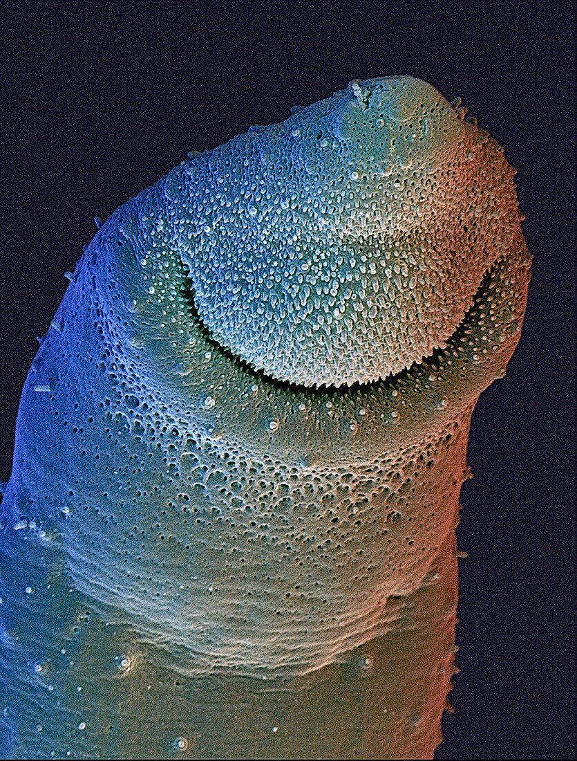 Schistosome fluke,SEM