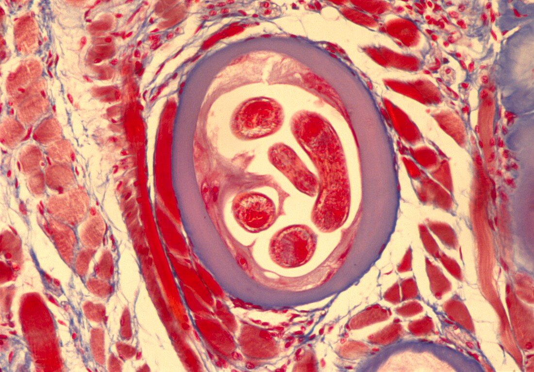 LM of a cyst caused by Trichinella spiralis