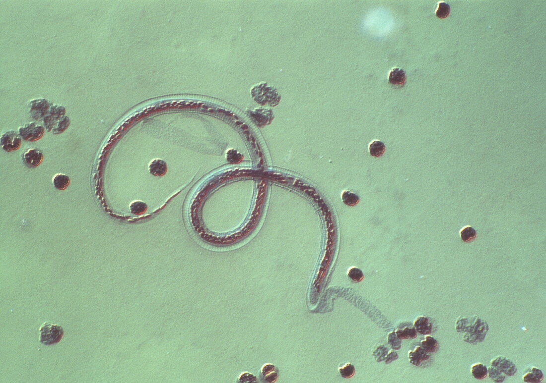 Wuchereria bancrofti parasite