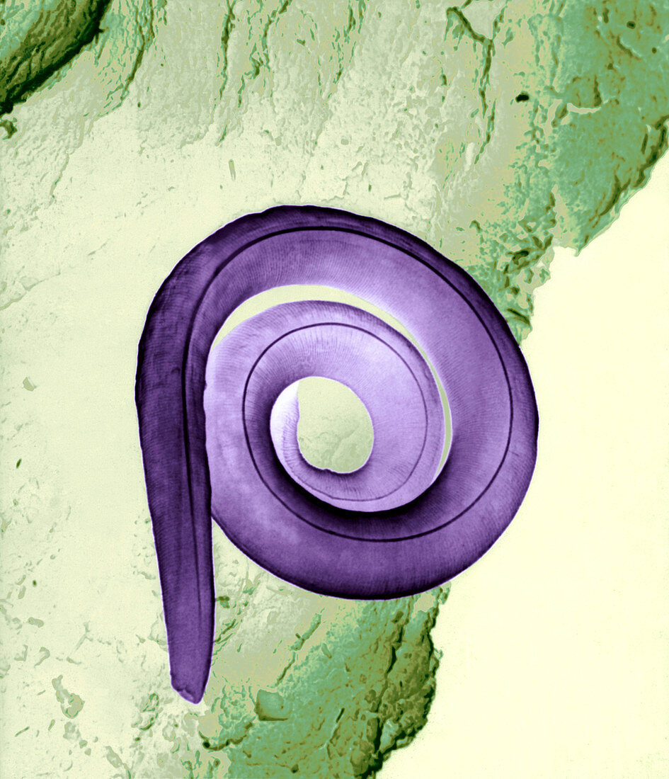 Nematode worm,SEM