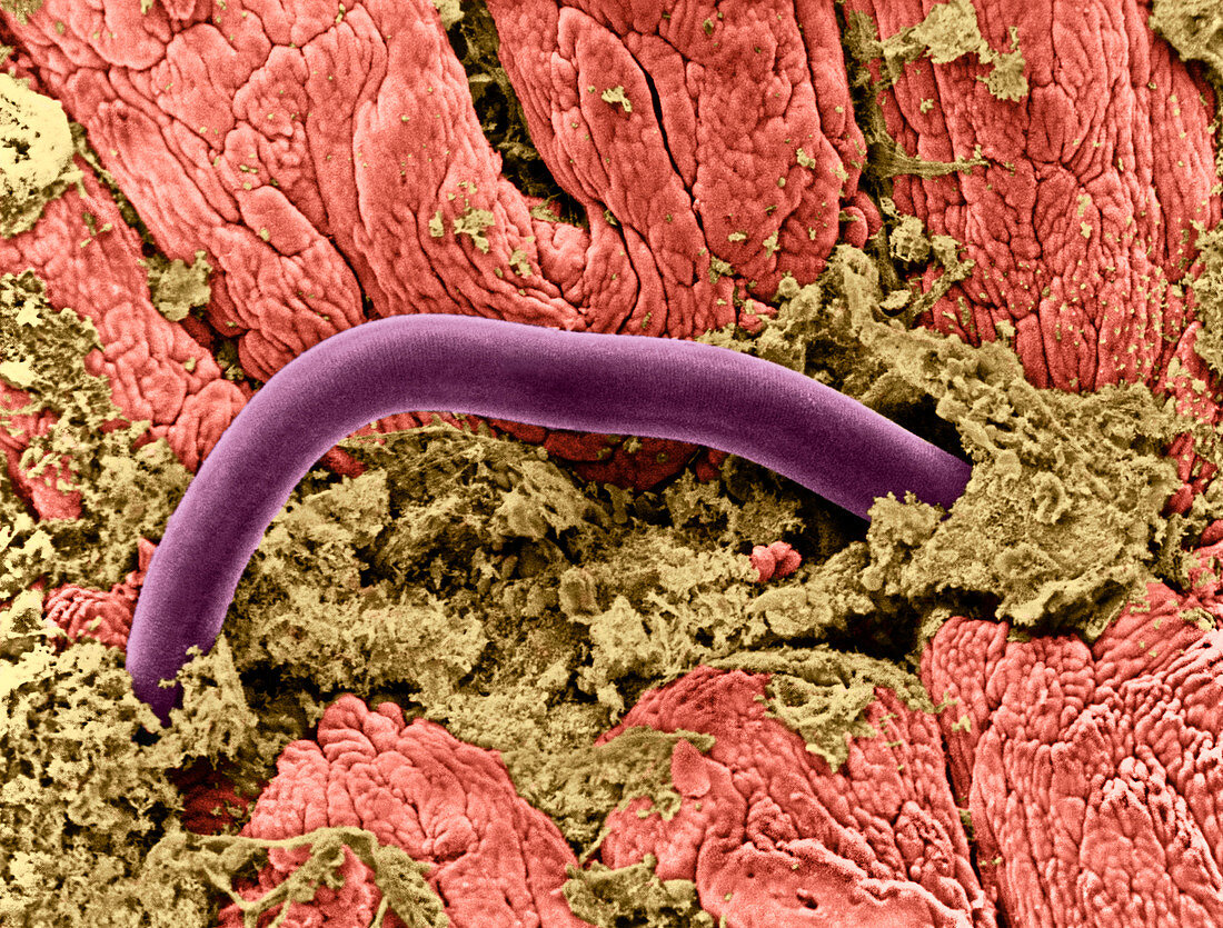 Threadworm in intestine,SEM