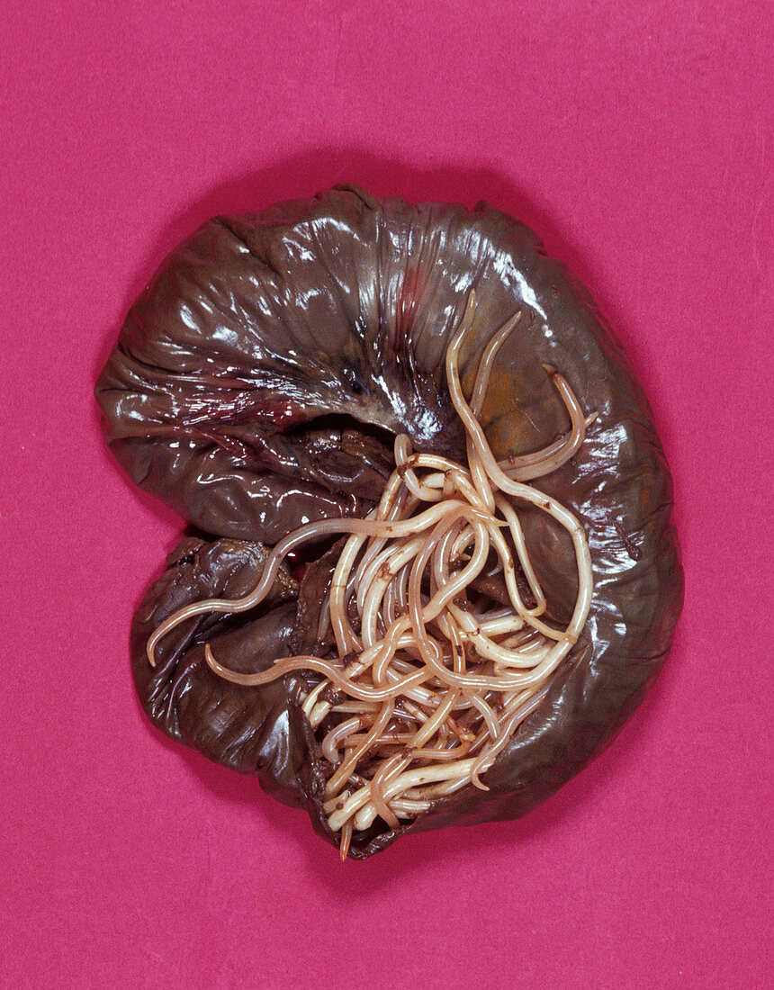 Roundworm obstruction