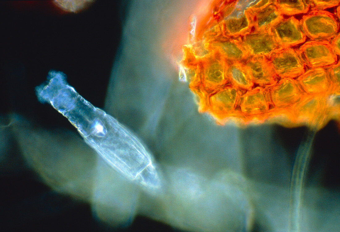 Light micrograph of a Bdelloid rotifer
