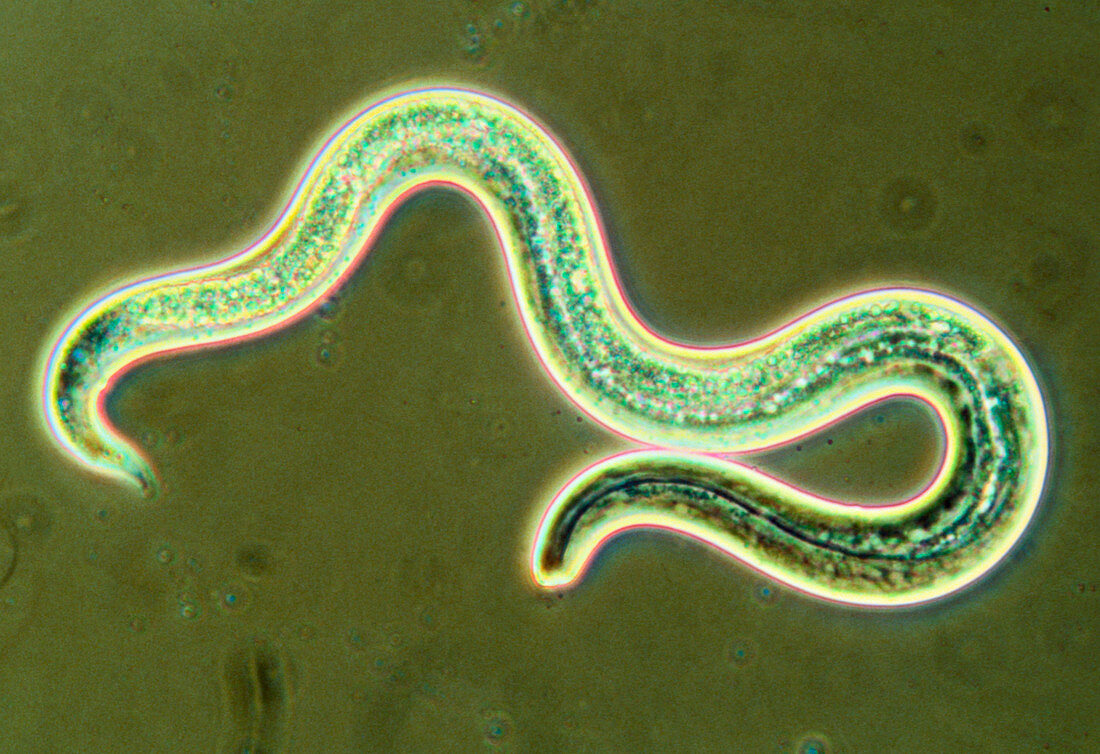 Micrograph of the first larval stage of roundworm