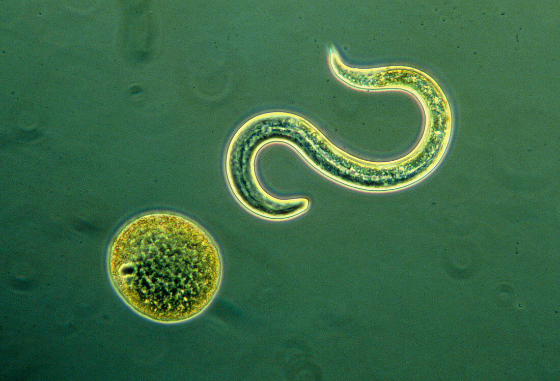 Lm of an egg & larval stage of dog roundworm