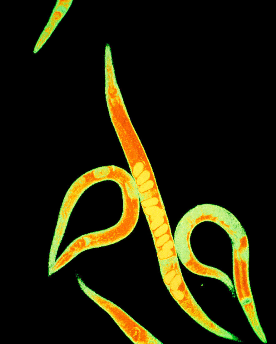 False-colour micrograph of Caenorhabditis elegans