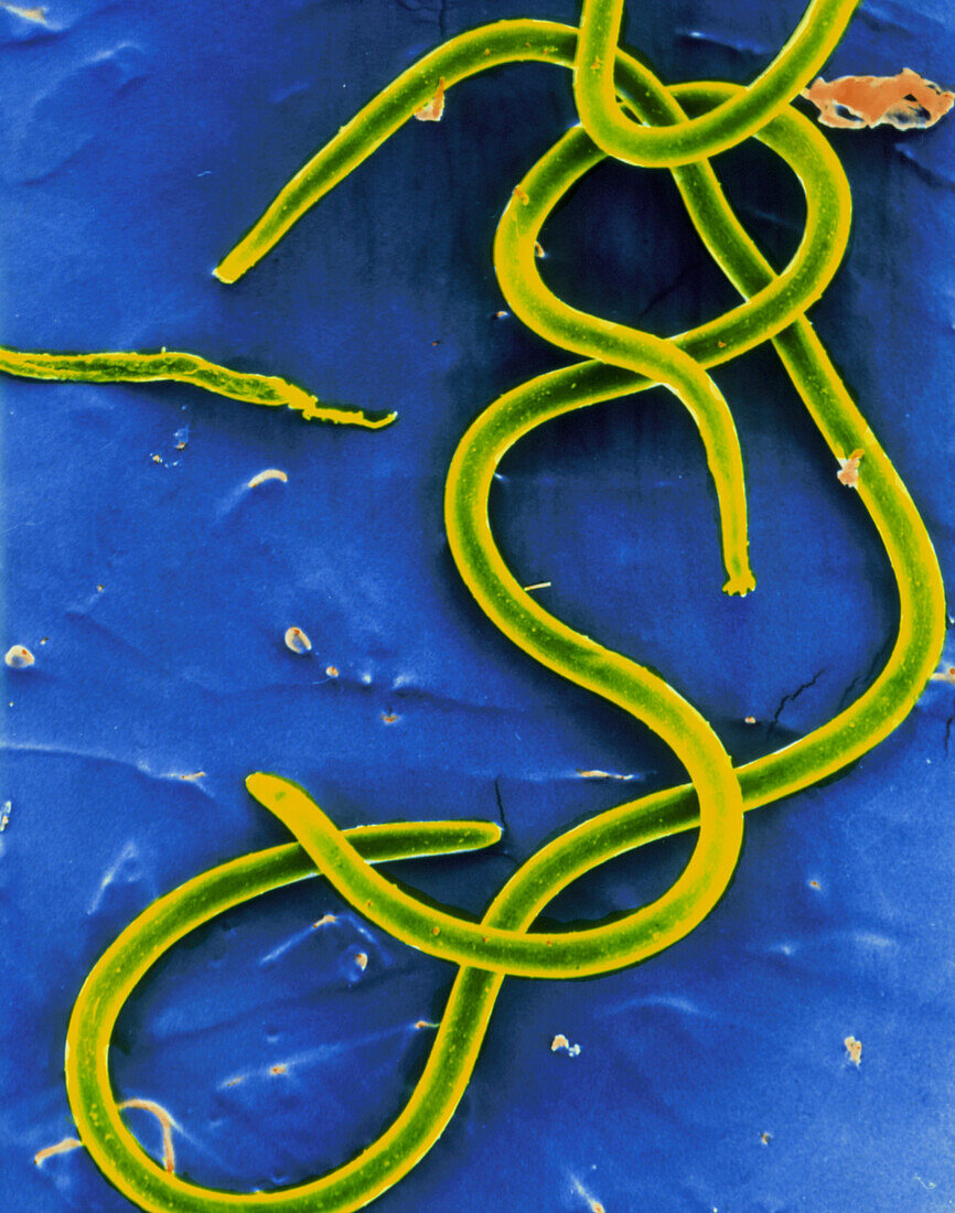 F/col SEM of mirofilariae (larval roundworms)