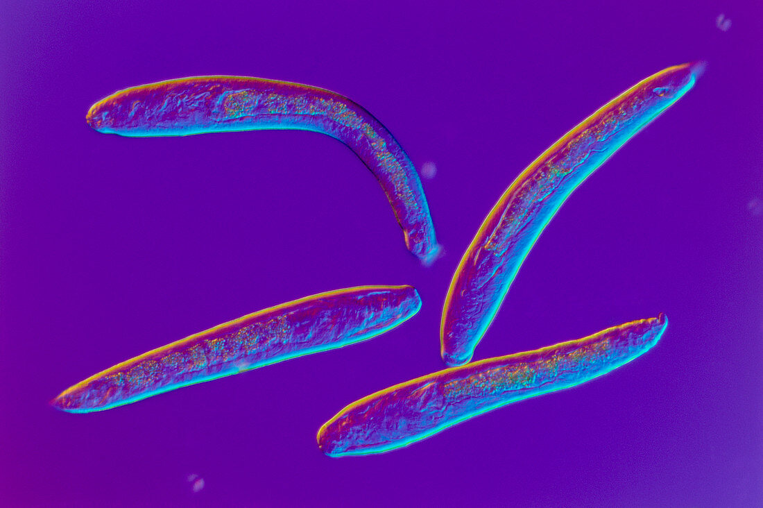 LM of larval nematode worm,Toxascaris leonina