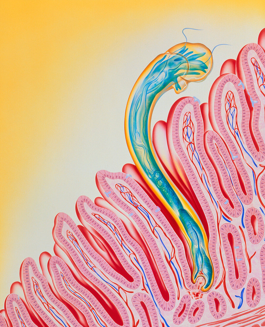Artwork of hookworm clinging to intestinal lining