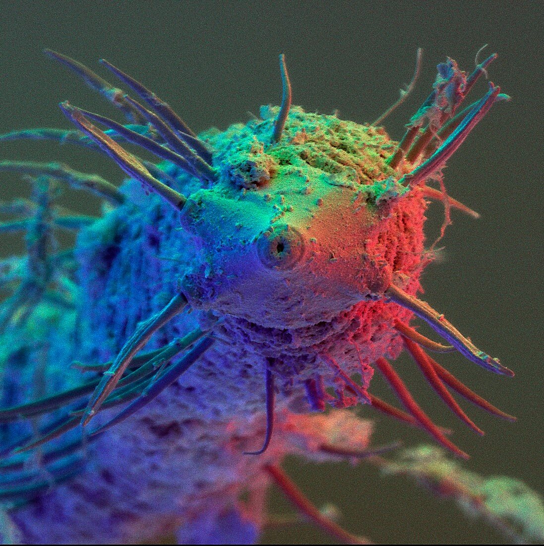 Coloured SEM of nematode worm order Desmoscolecida