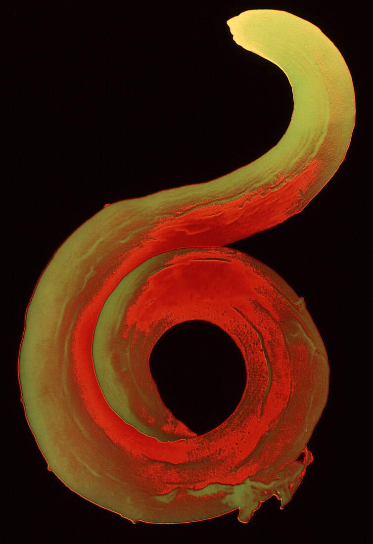 Toxocara roundworm