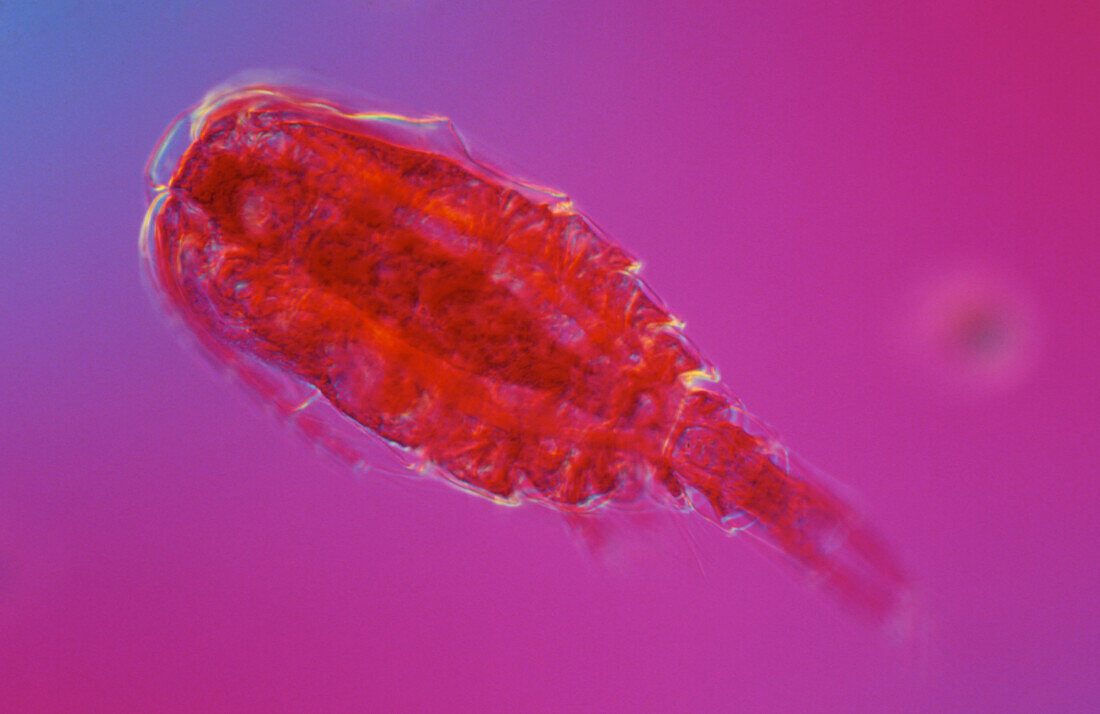 LM of the freshwater crustacean,Cyclops sp