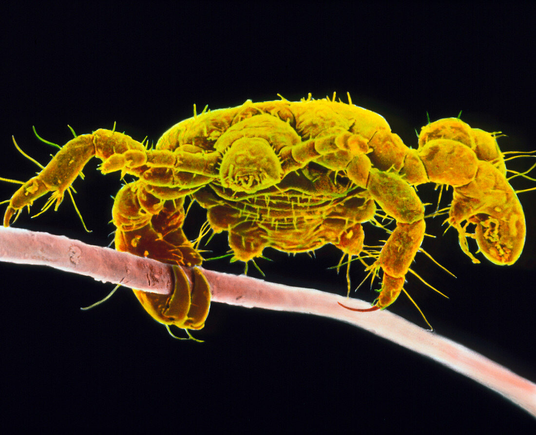 Coloured SEM of a pubic louse on a human hair