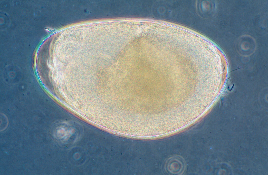Black fly egg,light micrograph