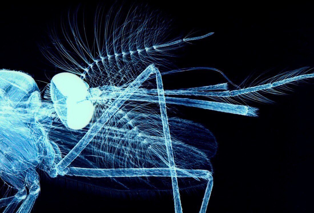 Male mosquito head,light micrograph