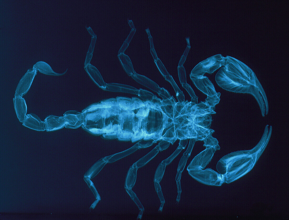 X-ray of the scorpion,Palamnaeus fulvipes